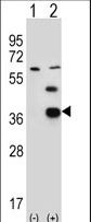 PDXK / PNK Antibody - Western blot of PDXK (arrow) using rabbit polyclonal PDXK Antibody (H13). 293 cell lysates (2 ug/lane) either nontransfected (Lane 1) or transiently transfected (Lane 2) with the PDXK gene.