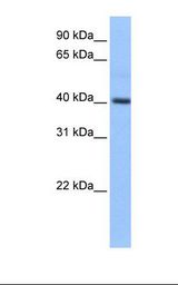 PDXK / PNK Antibody - Fetal liver cell lysate. Antibody concentration: 1.0 ug/ml. Gel concentration: 12%.  This image was taken for the unconjugated form of this product. Other forms have not been tested.
