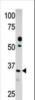 PDXK / PNK Antibody - Western blot of anti-PDXK in HepG2 cell line lysate (35 ug/lane). PDXK(arrow) was detected using the purified antibody.