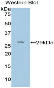 PDXK / PNK Antibody - Western blot of recombinant PDXK / PNK.  This image was taken for the unconjugated form of this product. Other forms have not been tested.