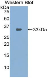 PDXK / PNK Antibody - Western blot of recombinant PDXK / PNK.