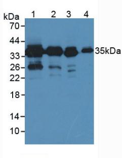 PDXK / PNK Antibody - Western Blot; Sample: Lane1: Mouse Liver Tissue; Lane2: Mouse Lung Tissue; Lane3: Rat Liver Tissue; Lane4: Human Hela Cells.