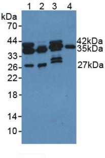PDXK / PNK Antibody - Western Blot; Sample: Lane1: Rat Liver Tissue; Lane2: Rat Lung Tissue; Lane3: Mouse Liver Tissue; Lane4: Human Hela Cells.