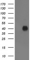 PDXK / PNK Antibody - HEK293T cells were transfected with the pCMV6-ENTRY control (Left lane) or pCMV6-ENTRY PDXK (Right lane) cDNA for 48 hrs and lysed. Equivalent amounts of cell lysates (5 ug per lane) were separated by SDS-PAGE and immunoblotted with anti-PDXK.