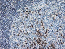 PDXK / PNK Antibody - IHC of paraffin-embedded Human lymph node tissue using anti-PDXK mouse monoclonal antibody.