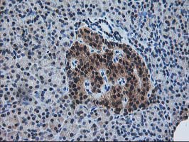 PDXK / PNK Antibody - IHC of paraffin-embedded Human pancreas tissue using anti-PDXK mouse monoclonal antibody.