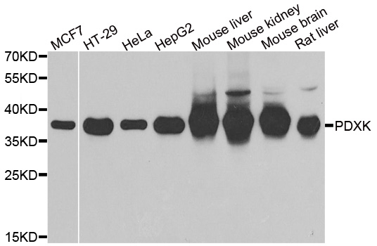 PDXK / PNK Antibody - Western blot analysis of extracts of various cell lines.