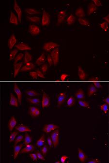 PDXK / PNK Antibody - Immunofluorescence analysis of U2OS cells.
