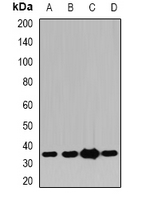 PDXK / PNK Antibody - Western blot analysis of Pyridoxal Kinase expression in HT29 (A); HeLa (B); mouse brain (C); rat liver (D) whole cell lysates.