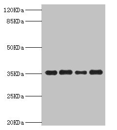PDXK / PNK Antibody - Western blot All Lanes:PDXK antibody at 5.63ug/ml Lane 1:mouse liver tissue Lane 2:Hela whole cell lysate Lane 3:mouse kidney tissue Lane 4:HepG2 whole cell lysate Secondary Goat polyclonal to rabbit at 1/10000 dilution Predicted band size: 36,32,27 kDa Observed band size: 35 kDa