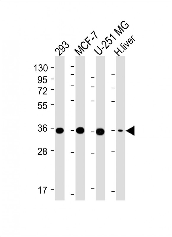 PDXK / PNK Antibody - All lanes: Anti-PDXK Antibody (N-term) at 1:4000 dilution Lane 1: 293 whole cell lysate Lane 2: MCF-7 whole cell lysate Lane 3: U-251 MG whole cell lysate Lane 4: Human liver lysate Lysates/proteins at 20 µg per lane. Secondary Goat Anti-mouse IgG, (H+L), Peroxidase conjugated at 1/10000 dilution. Predicted band size: 35 kDa Blocking/Dilution buffer: 5% NFDM/TBST.