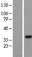 PDXK / PNK Protein - Western validation with an anti-DDK antibody * L: Control HEK293 lysate R: Over-expression lysate