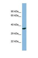 PDXP / Pyridoxal Phosphatase Antibody - Western blot of Human HT1080 . PDXP antibody dilution 1.0 ug/ml.  This image was taken for the unconjugated form of this product. Other forms have not been tested.