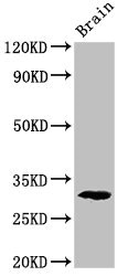 PDXP / Pyridoxal Phosphatase Antibody - Positive Western Blot detected in Rat brain tissue. All lanes: Pdxp antibody at 2.8 µg/ml Secondary Goat polyclonal to rabbit IgG at 1/50000 dilution. Predicted band size: 32 KDa. Observed band size: 32 KDa