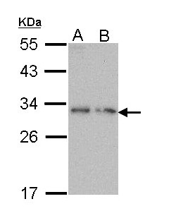 PDYN / ProDynorphin Antibody - Sample (30 ug of whole cell lysate). A: Molt-4 , B: Raji. 12% SDS PAGE. PDYN / ProDynorphin antibody diluted at 1:1000.
