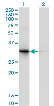 PDYN / ProDynorphin Antibody - Western Blot analysis of PDYN expression in transfected 293T cell line by PDYN monoclonal antibody (M01), clone 2E12.Lane 1: PDYN transfected lysate(28.4 KDa).Lane 2: Non-transfected lysate.