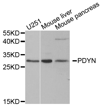 PDYN / ProDynorphin Antibody - Western blot analysis of extracts of various cell lines.