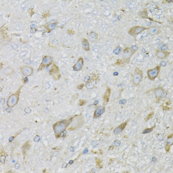 PDYN / ProDynorphin Antibody - Immunohistochemistry of paraffin-embedded mouse brain tissue.