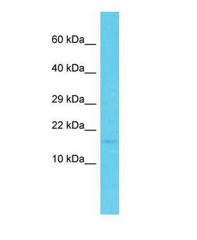 PDZD11 / PISP Antibody - Western blot of PDZD11 Antibody - C-terminal region with human OVCAR-3 cells lysate.  This image was taken for the unconjugated form of this product. Other forms have not been tested.