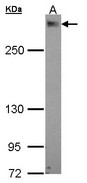 PDZD2 Antibody - Sample (30 ug of whole cell lysate). A: A549 5% SDS PAGE. PDZD2 / PAPIN antibody diluted at 1:1000.