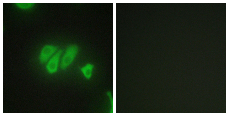 PDZD2 Antibody - Immunofluorescence analysis of HepG2 cells, using PDZD2 Antibody. The picture on the right is blocked with the synthesized peptide.