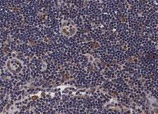 PDZD2 Antibody - 1:100 staining human lymph node tissue by IHC-P. The tissue was formaldehyde fixed and a heat mediated antigen retrieval step in citrate buffer was performed. The tissue was then blocked and incubated with the antibody for 1.5 hours at 22°C. An HRP conjugated goat anti-rabbit antibody was used as the secondary.
