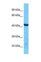 PDZD3 Antibody - Western blot of Human HepG2. PDZD3 antibody dilution 1.0 ug/ml.  This image was taken for the unconjugated form of this product. Other forms have not been tested.