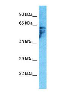 PDZD3 Antibody - Western blot of Human HepG2. PDZD3 antibody dilution 1.0 ug/ml.  This image was taken for the unconjugated form of this product. Other forms have not been tested.