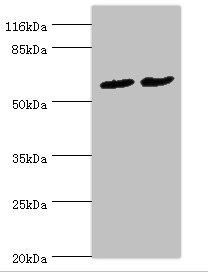 PDZD3 Antibody - Western blot All Lanes:PDZD3 antibody at 2ug/ml Lane 1:mouse kidney tissue Lane 2:mouse heart tissue Secondary Goat polyclonal to rabbit at 1/10000 dilution Predicted band size: 62,55,53,42,25 kDa Observed band size: 61 kDa