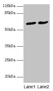 PDZD3 Antibody - Western blot All lanes: PDZD3 antibody at 2µg/ml Lane 1: Mouse kidney tissue Lane 2: Mouse heart tissue Secondary Goat polyclonal to rabbit IgG at 1/10000 dilution Predicted band size: 62, 55, 53, 42, 25 kDa Observed band size: 62 kDa