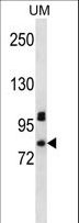 PDZD4 Antibody - PDZD4 Antibody western blot of uterine tumor cell line lysates (35 ug/lane). The PDZD4 antibody detected the PDZD4 protein (arrow).