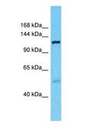 PDZD8 Antibody - Western blot of PDZD8 Antibody with human Fetal Lung lysate.  This image was taken for the unconjugated form of this product. Other forms have not been tested.