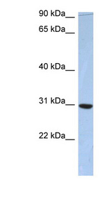 PDZD9 Antibody - PDZD9 / C16orf65 antibody Western blot of Fetal Small Intestine lysate. This image was taken for the unconjugated form of this product. Other forms have not been tested.