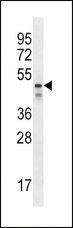 PDZK1 Antibody - PDZK1 Antibody western blot of NCI-H292 cell line lysates (35 ug/lane). The PDZK1 antibody detected the PDZK1 protein (arrow).