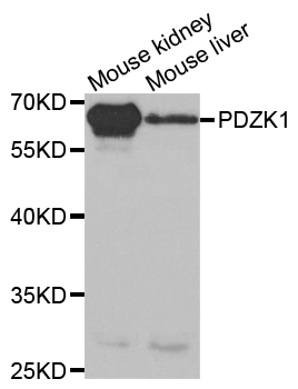 PDZK1 Antibody - Western blot analysis of extracts of various cell lines.