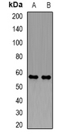 PDZK1 Antibody - Western blot analysis of PDZK1 expression in mouse kidney (A); mouse liver (B) whole cell lysates.