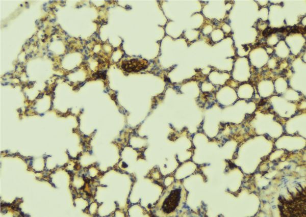 PDZK1 Antibody - 1:100 staining mouse lung tissue by IHC-P. The sample was formaldehyde fixed and a heat mediated antigen retrieval step in citrate buffer was performed. The sample was then blocked and incubated with the antibody for 1.5 hours at 22°C. An HRP conjugated goat anti-rabbit antibody was used as the secondary.
