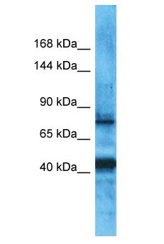 PDZRN3 Antibody - PDZRN3 antibody Western Blot of Uterus Tumor. Antibody dilution: 1 ug/ml.  This image was taken for the unconjugated form of this product. Other forms have not been tested.