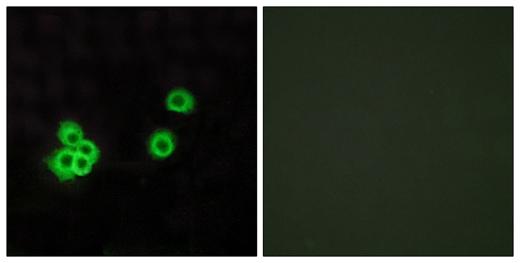 PEA15 / PEA-15 Antibody - Immunofluorescence analysis of MCF7 cells, using PEA15 Antibody. The picture on the right is blocked with the synthesized peptide.