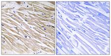 PEA15 / PEA-15 Antibody - Immunohistochemistry analysis of paraffin-embedded human heart tissue, using PEA-15 Antibody. The picture on the right is blocked with the synthesized peptide.