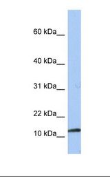 PEA15 / PEA-15 Antibody - 721_B cell lysate. Antibody concentration: 1.0 ug/ml. Gel concentration: 10-20%.  This image was taken for the unconjugated form of this product. Other forms have not been tested.