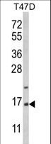 PEA15 / PEA-15 Antibody - Western blot of PEA-15 Antibody in T47D cell line lysates (35 ug/lane). PEA-15 (arrow) was detected using the purified antibody.