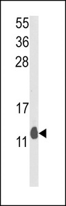PEA15 / PEA-15 Antibody - Western blot of PEA-15 Antibody in mouse lung tissue lysates (35 ug/lane). PEA-15 (arrow) was detected using the purified antibody.