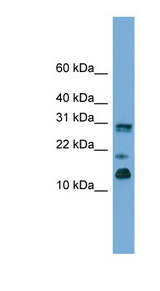PEA15 / PEA-15 Antibody - PEA15 antibody Western blot of Fetal Brain lysate.  This image was taken for the unconjugated form of this product. Other forms have not been tested.