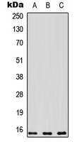 PEA15 / PEA-15 Antibody - Western blot analysis of PEA15 expression in MDA-MB231 (A); human kidney (B); NIH3T3 (C) whole cell lysates.
