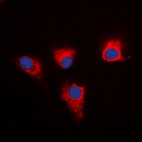 PEA15 / PEA-15 Antibody - Immunofluorescent analysis of PEA15 staining in MDA-MB-231 cells. Formalin-fixed cells were permeabilized with 0.1% Triton X-100 in TBS for 5-10 minutes and blocked with 3% BSA-PBS for 30 minutes at room temperature. Cells were probed with the primary antibody in 3% BSA-PBS and incubated overnight at 4 deg C in a humidified chamber. Cells were washed with PBST and incubated with a DyLight 594-conjugated secondary antibody (red) in PBS at room temperature in the dark. DAPI was used to stain the cell nuclei (blue).