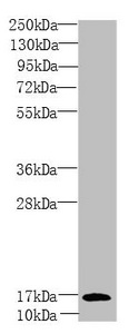 PEA15 / PEA-15 Antibody - Western blot All Lanes:PEA15 antibody at 1.81 ug/ml +Mouse brain tissue Secondary Goat polyclonal to rabbit IgG at 1/10000 dilution Predicted band size: 16,18 kDa Observed band size: 15 kDa
