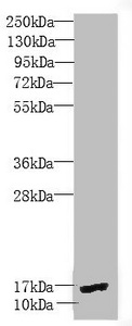 PEA15 / PEA-15 Antibody - Western blot All Lanes:PEA15 antibody at 1.9 ug/ml +Mouse brain tissue Secondary Goat polyclonal to rabbit IgG at 1/10000 dilution Predicted band size: 16,18 kDa Observed band size: 15 kDa