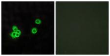 PEA15 / PEA-15 Antibody - Peptide - + Immunofluorescence analysis of MCF-7 cells, using PEA15 antibody.