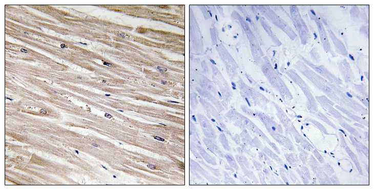 PEA15 / PEA-15 Antibody - Immunohistochemistry analysis of paraffin-embedded human heart, using PEA-15 (Phospho-Ser104) Antibody. The picture on the right is blocked with the phospho peptide.
